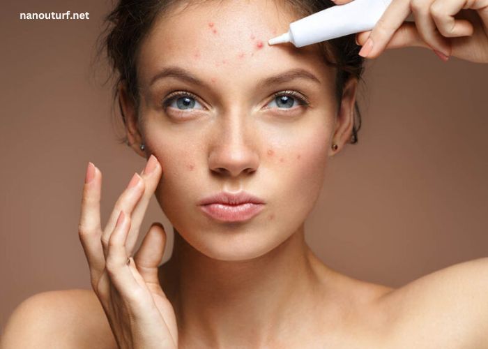 The Clearskinstudy Email Info: Exploring Effective Solutions For Acne Treatment